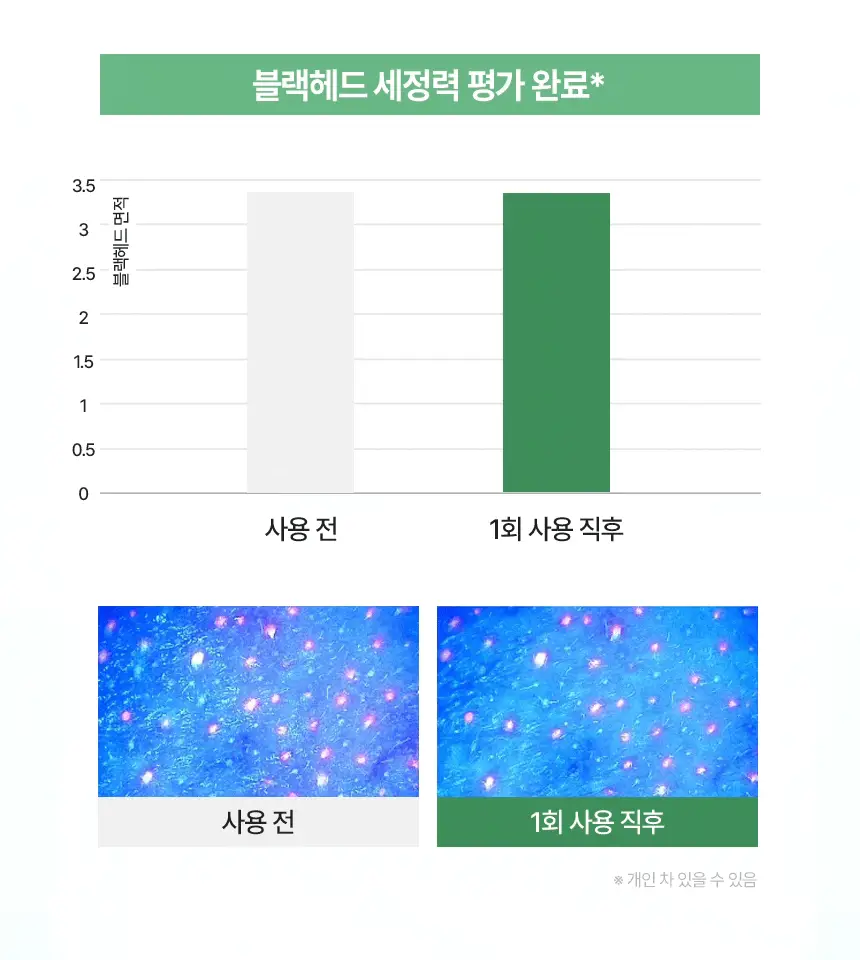 [단품] 듀댑 팩클렌저 150ml 3종(시카티/듀톡스/레몬 커스터드] 상세페이지 38